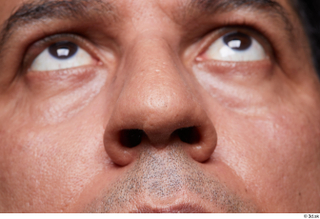 HD Face Skin Nadheer Wakim face nose skin pores skin…